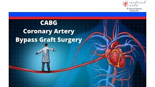 Open Heart - Cabg Surgery - Coronary Artery Bypass Graft  -  On Vs Off Pump Or. 4K