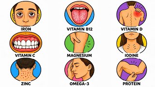 Every Nutrient Deficiency and it’s Effects Explained