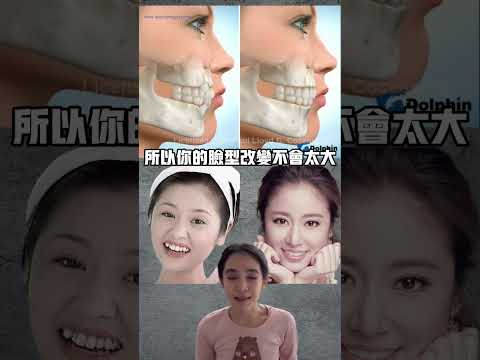 為什麼有些人拔牙矯正臉型變很多，有些人沒什麼變#戴牙套 ...