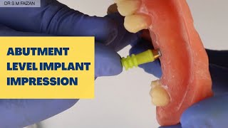 Abutment Level Implant Impression