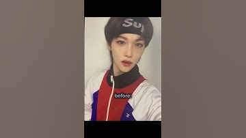 Kpop idols who did unnecessary plastic surgery #straykids #skz #felix #fyp #stay #plastic #shorts