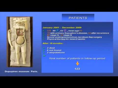 Massimiliano Tripoli MD, Department of Plastic and Reconstructive Surgery, University of Palermo, Palermo, Italy presents "The "Jacobsen flap" for the treatment of stage III-IV Dupuytren's disease at the little finger: our review of 123 cases" at the 2010 Miami Dupuytren Symposium