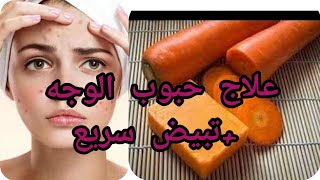 # تبيض#ازالة حبوب الوجه # الظهر # بصابون الجزر