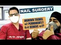Ingrown toenail permanent treatment ingrown toenail surgery in delhi  dr jangid skinqure