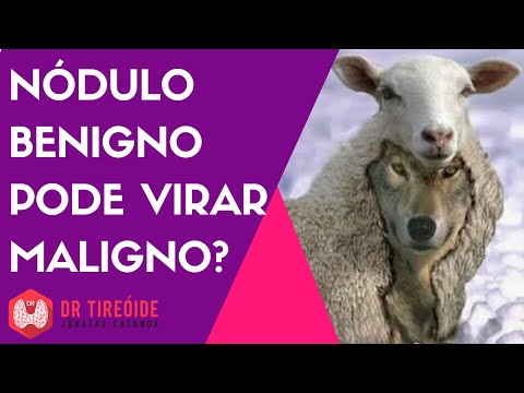 Vídeo: Os tumores malignos doem?