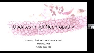 'Updates in IgA Nephropathy' presented by Natalie Beck, MD