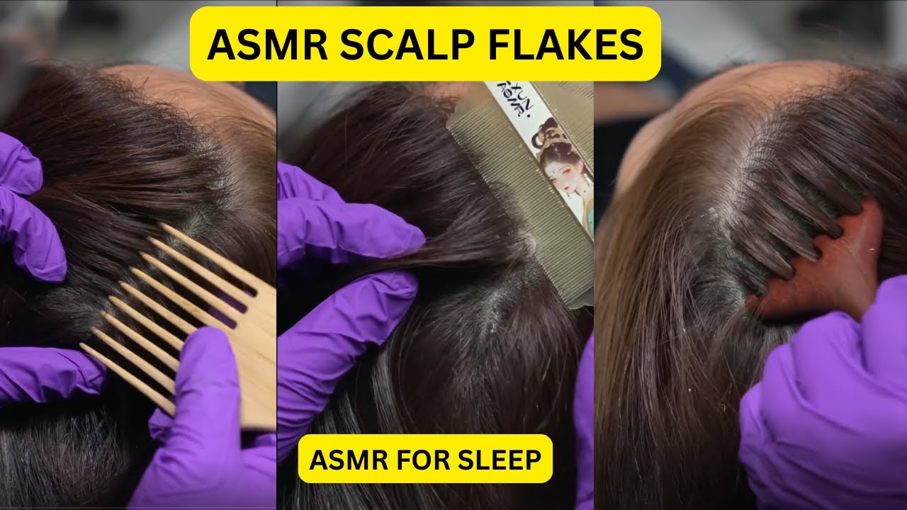 ASMR Dandruff Scratch Sounds @DizzyKitten_ASMR