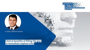 Clinical benefits of filling the gap at immediate implant sites by Dr. R. Carvalho Da Silva