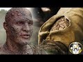 Greyscale Disease Explained | Game of Thrones Season 7