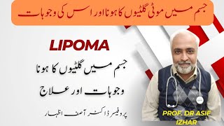 How To Cure LIPOMA Naturally | What Is Lipoma (लाइपोमा) | Lipoma Kya Hota Hai | Lipoma Ka Ilaj Urdu Resimi