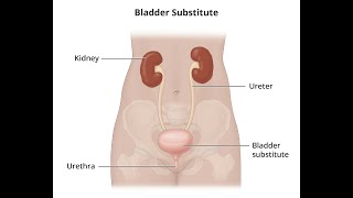 Anastomosis of single ureter to bladder CPT code - simplify medical coding