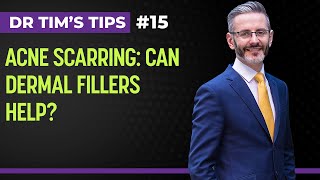 Acne Scarring: Can Dermal Fillers Help? | Dr Tim's Tips