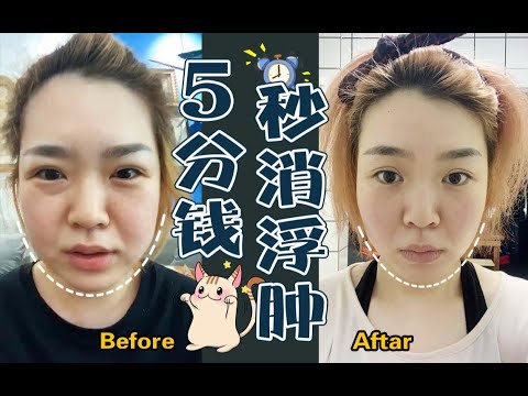 【祛水肿】眼睛|脸部|身体|最有效的祛水肿＋变成不水肿体质方法！