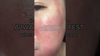Always patch test! #patchtest #skincare #sensitiveskin #skincaretips #skincareroutine #kbeauty