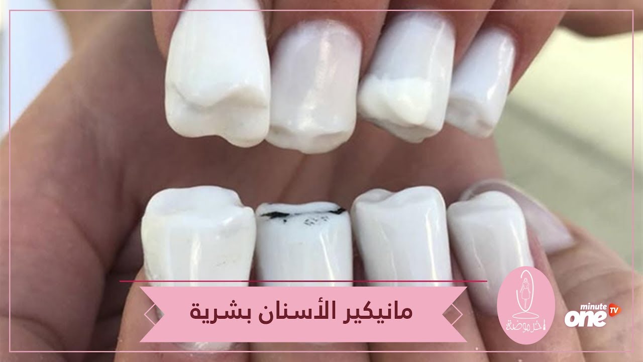 компактостеотомия в области одного зуба. Looks like teeth. брекеты металлические damon q. пластиковые зубы. компактостеотомия в стоматологии.