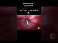 ماذا يحدث عند بلع كبسولة معرفة حول العالم Aroundtheworld ثقافة طب ماذا يحدث عند بلع كبسولة معرفة حول العالم Aroundtheworld ثقافة طب