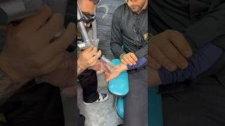 Removing Tattoos With Picosecond Laser