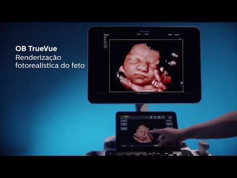 Philips: Nova Geração