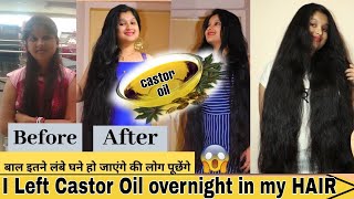 I Left CASTOR OIL in my hair OVERNIGHT & THIS HAPPENED *best results ever!*|Prakshi Versatile