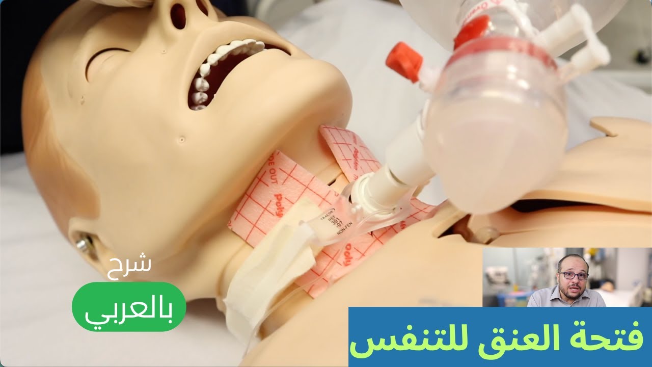 Трахеостомическое отверстие, его части, типы и причины его применения