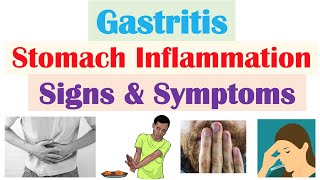 Gastritis (Stomach Inflammation) Signs & Symptoms, Complications (& Why They Occur) screenshot 1