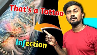 Tattoo Infection Signs And what To Do To FIX IT! || Tattoo infection signs