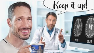 Smoldering MS: The Silent Progression Your Doctor Might Miss