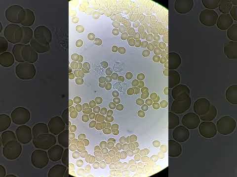 White Blood Cells fighting under microscope!