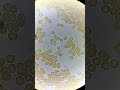 White Blood Cells fighting under microscope!