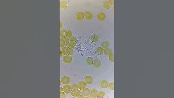 White Blood Cells fighting under microscope!