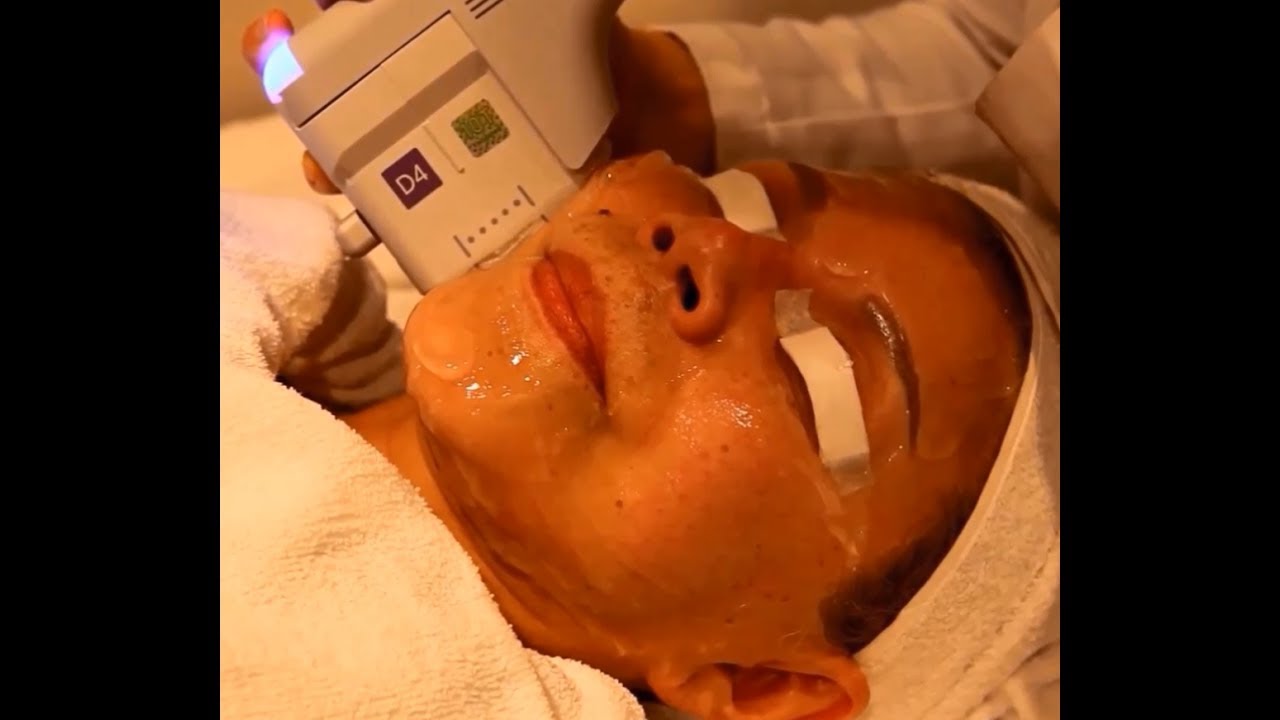 Non-Surgical Laser Facelift Anti-aging in Korea | Seoul Guide Medical
