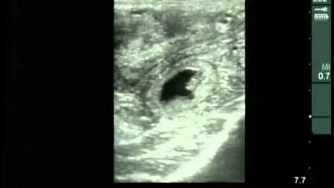 Cow #4539 Day 29 of Gestation