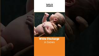 White Discharge in Newborn Babies | Causes, Care, and When to meet doctor