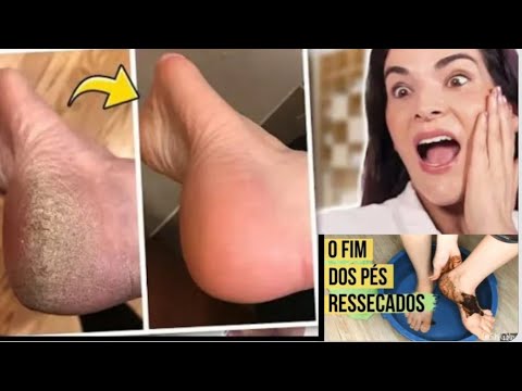 Kommee Issin Baqaquufi Kunootyi Dawaanni Guyya Muraasatti Issinirra Baleessa