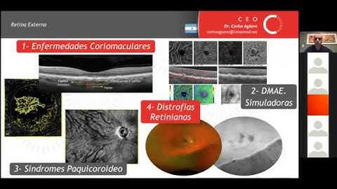 Curso OCT y OCT-A - Módulo 4
