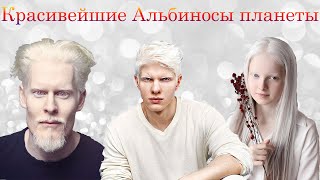 Красивейшие альбиносы планеты- Альбиносы модели