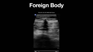 Soft Tissue Foreign Bodies screenshot 5