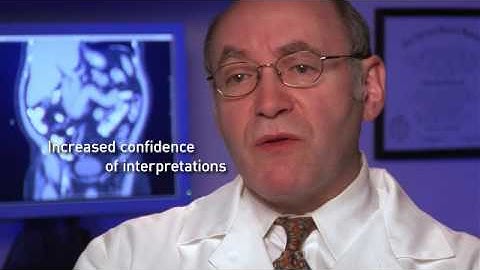 iCAD: Never Stop Looking