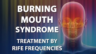 Burning Mouth Syndrome - RIFE Frequencies Treatment - Energy & Quantum Medicine with Bioresonance
