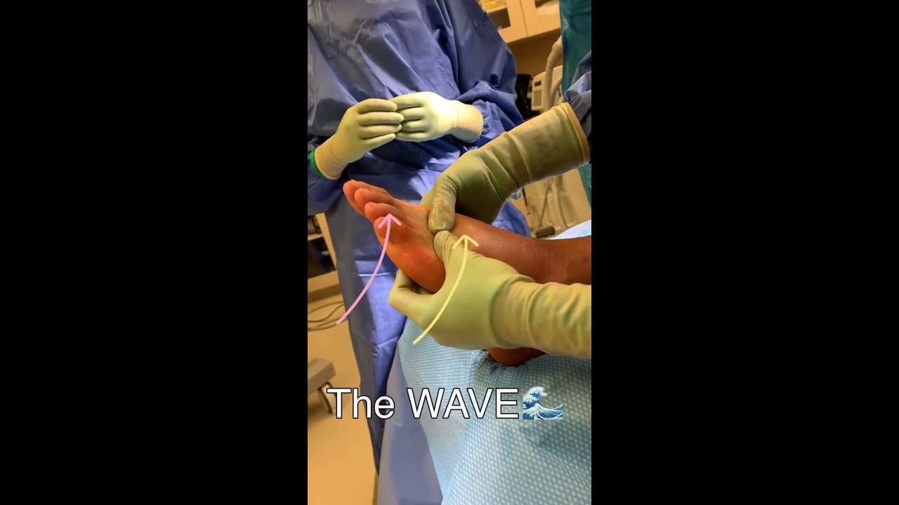 Swelling is the Enemy! #surgery #ankle #edema #postoprecovery #postopcare