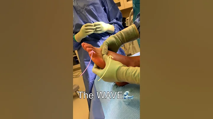 Swelling is the Enemy! #surgery #ankle #edema #postoprecovery #postopcare - DayDayNews