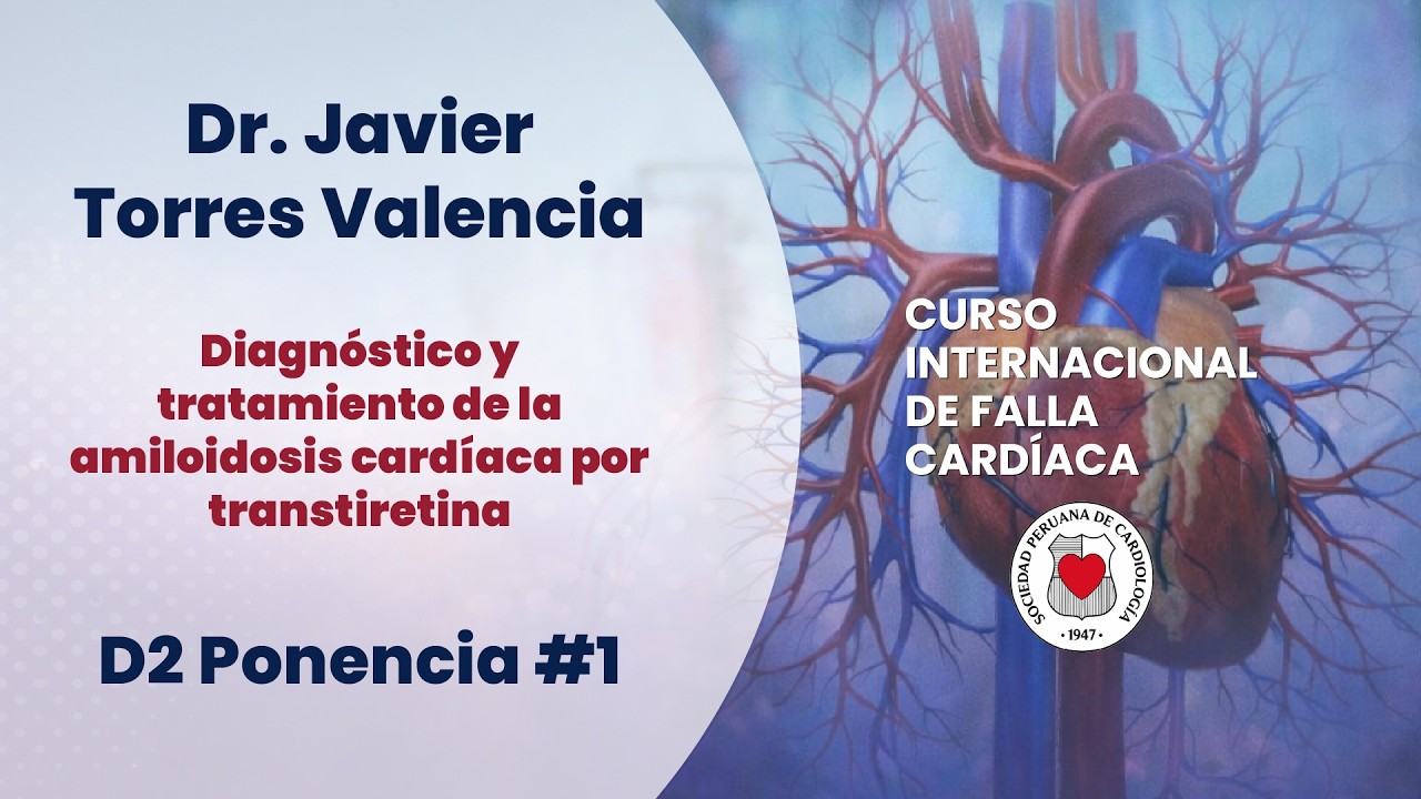 Diagnóstico y tratamiento de la amiloidosis cardíaca por transtiretina