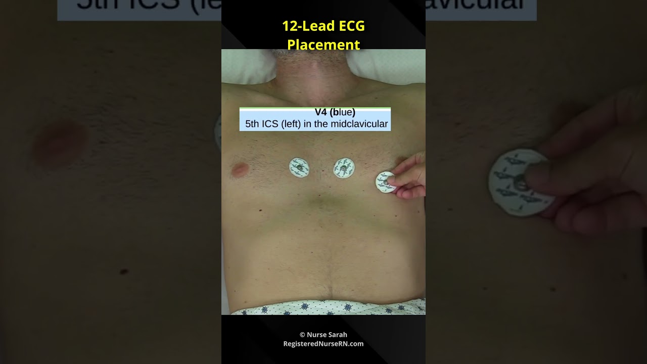 12-Lead ECG / EKG Electrode Placement for Nursing School Students & Nurses 