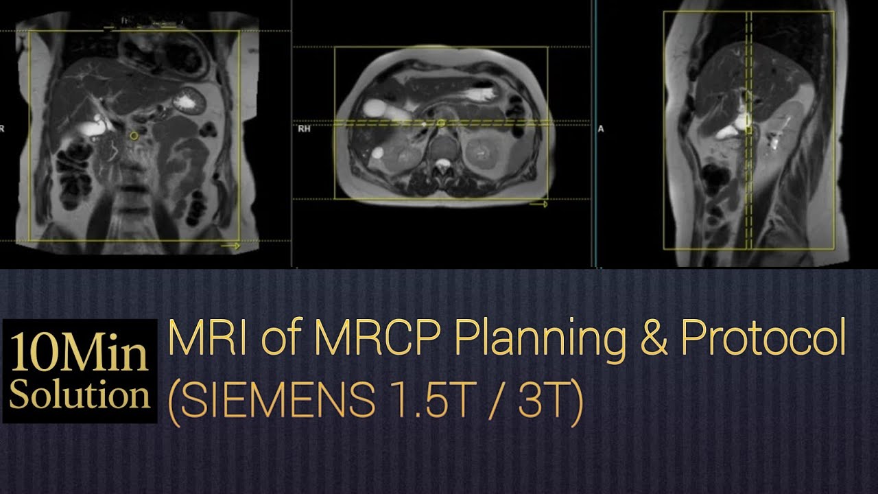 How to Plan MRCP | Siemens 1.5T / 3T | Complete Step-by-Step Guide