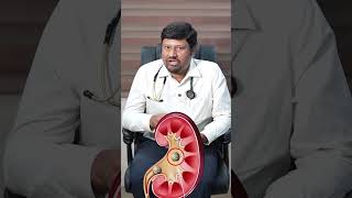 Know About Kidney Calcium Oxalate Stones