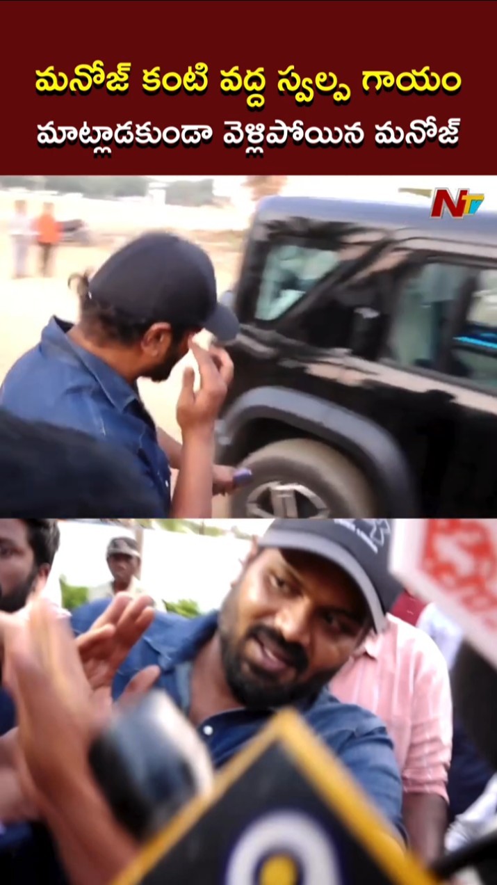 మనోజ్ కంటి వద్ద స్వల్ప గాయం l Manchu Manoj l NTV