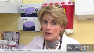 Flu - Prevention NBC30