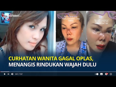 Curhatan Pilu Wanita Gagal Operasi Plastik, Menangis Rindukan Wajah yang Dulu