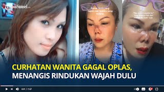 Curhatan Pilu Wanita Gagal Operasi Plastik, Menangis Rindukan Wajah yang Dulu