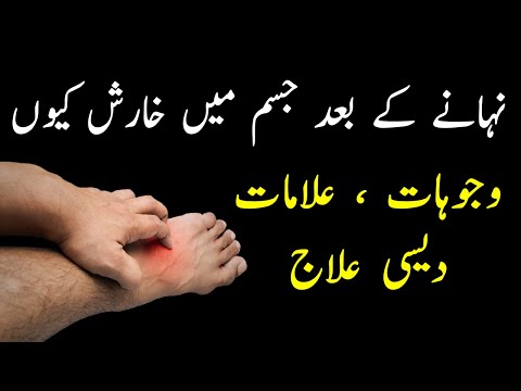 Itching Body After Bath Nahane Ke Bad Kharish Kiyun Hoti Hai